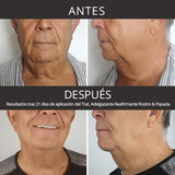 Tratamiento Adelgazante Reafirmante Rostro & Papada - Elimina volumen en cara y cuello y evita el descolgamiento