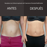 Tratamiento Drenante Reafirmante - Alivio inmediato de la hinchazón, ligereza y máxima firmeza