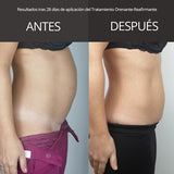 Tratamiento Drenante Reafirmante - Alivio inmediato de la hinchazón, ligereza y máxima firmeza