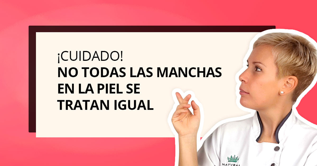 ¡No todas las manchas en la piel se tratan igual!