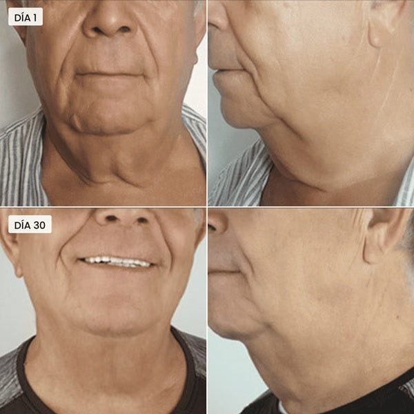 Tratamiento Adelgazante Reafirmante Rostro & Papada