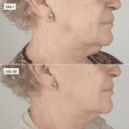 Tratamiento Adelgazante Reafirmante Rostro & Papada