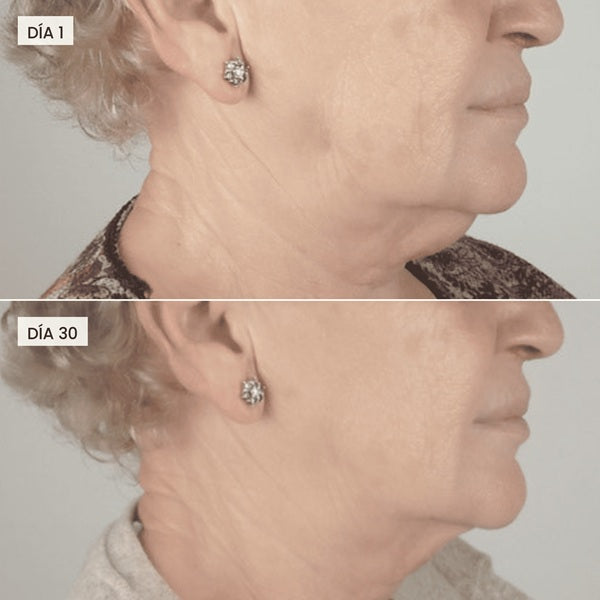 Tratamiento Adelgazante Reafirmante Rostro & Papada