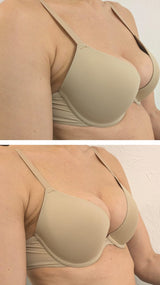 Tratamiento Belleza del Pecho - Aumenta, reafirma y eleva el pecho + acción antiestrías sin cirugía