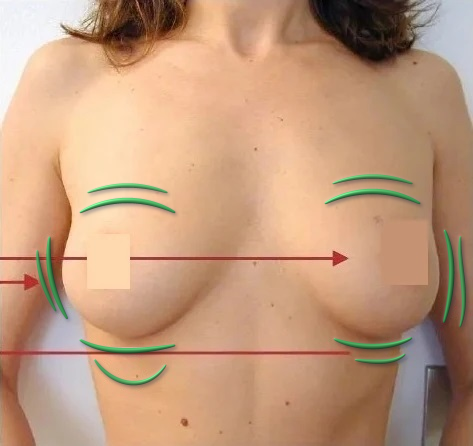 Tratamiento para la belleza del pecho