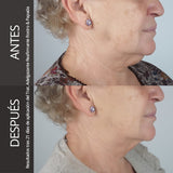 Tratamiento Adelgazante Reafirmante Rostro & Papada - Elimina volumen en cara y cuello y evita el descolgamiento