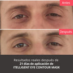 Intelligent Eye Contour Mask 30ml - Antiarrugas, reductor de bolsas y lifting de párpados y labios
